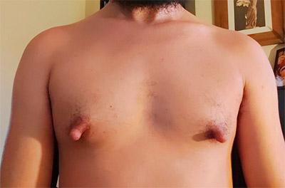 Essa é pra quem curte mamilos inchados