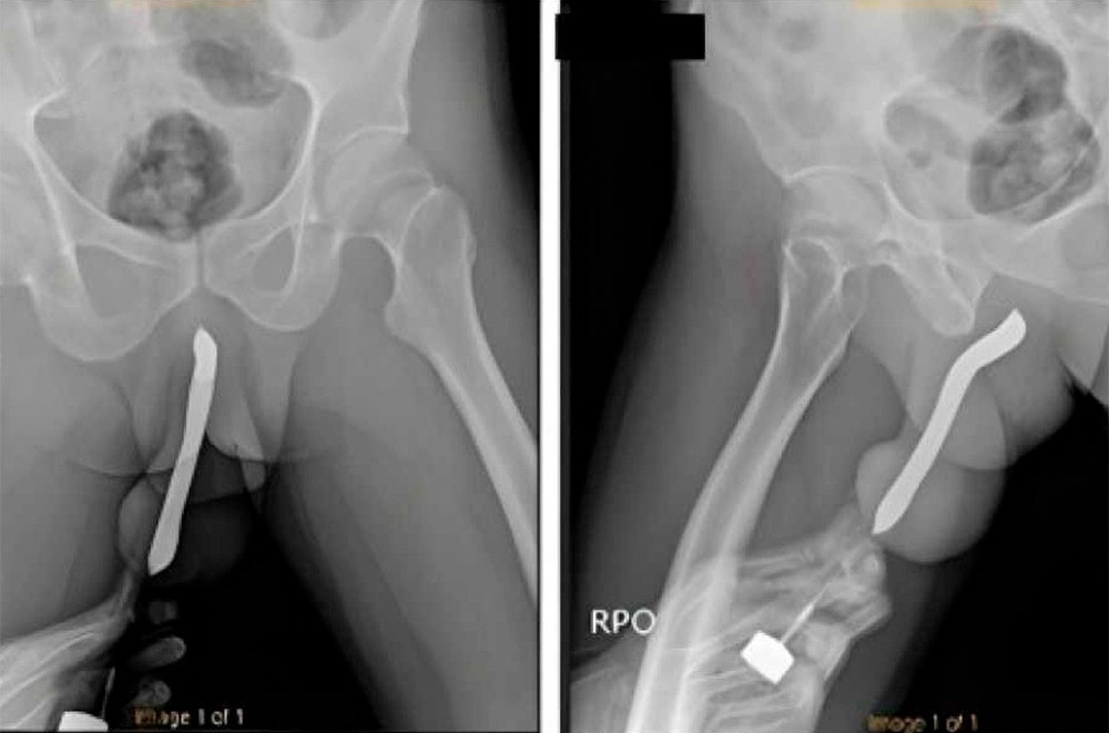 Casos bizarros pós-sexo